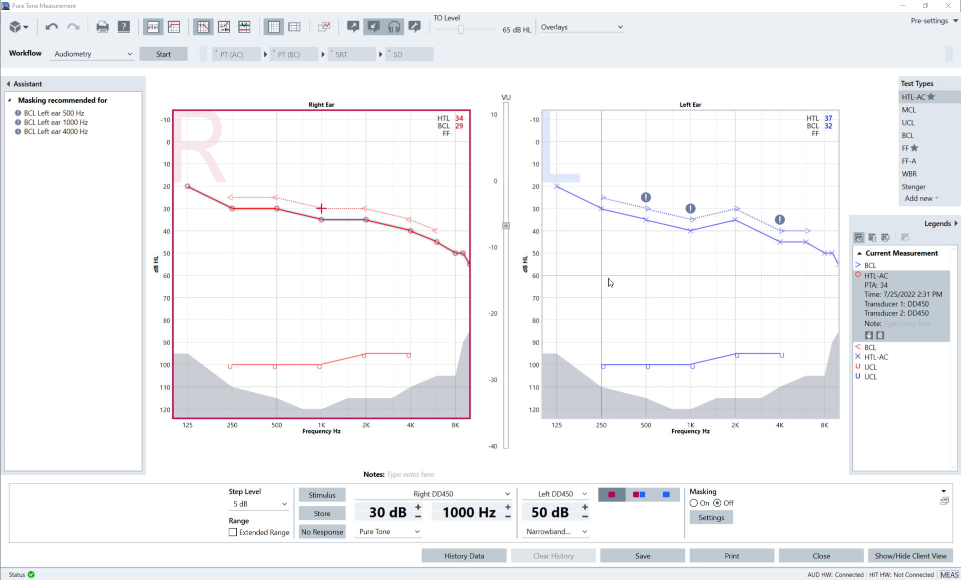 New: Pure Tone View w. masking recommendation